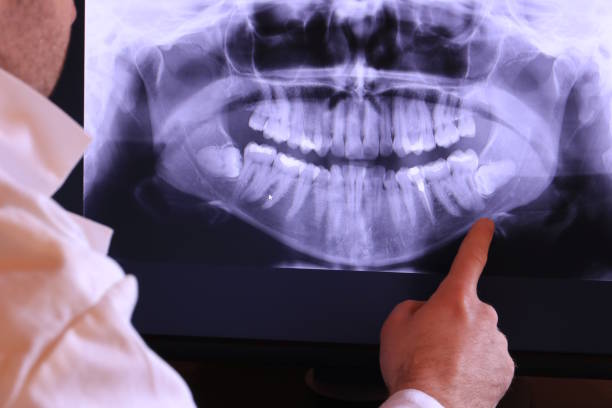 Best Emergency Treatment for Oral Infections in Stem, NC